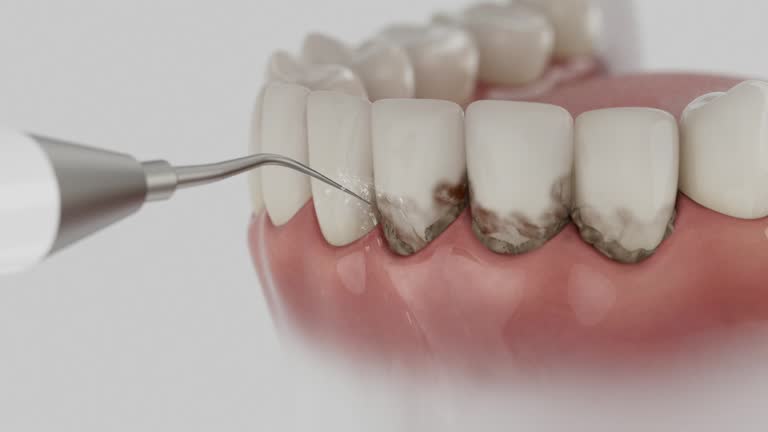 Reliable Dental contractor in Cameron Parish County, LA by Dentist Open Now